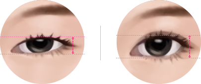 Big and clear eyes, distance between the eyelid and iris