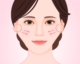 Gò má cao và có xu hướng đẩy dồn về phía trước