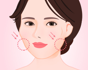 Gò má quá cao khiến má bị hóp và bị khuất