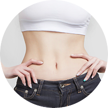 Hút mỡ bụng + co cơ bụng