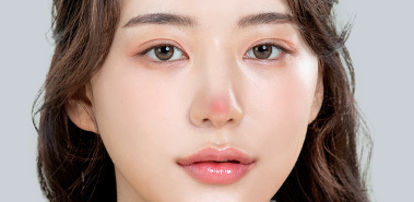 Lý do và phương pháp điều trị của phẫu thuật sửa mũi 6
