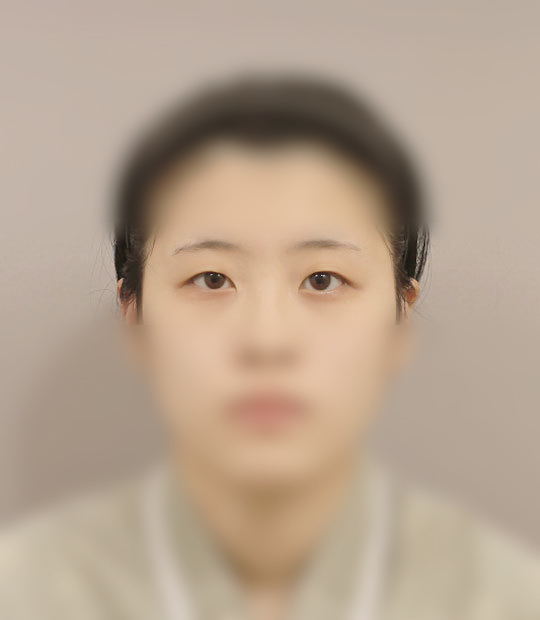 ảnh trước khi nhấn mí 1